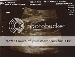 Image result for Baby Sonogram