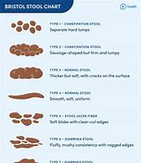 Image result for White Stool Chart