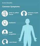 Image result for Sinus Infection Inside Nose