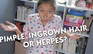 Image result for Ingrown Hair Pimple