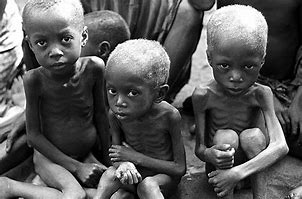 Image result for Starving Babies in Africa