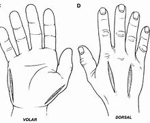 Image result for Volar and Dorsal Hand