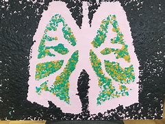 Image result for Asthma Painting