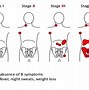 Image result for Lymphoma Panel