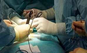 Image result for Cancer Surgery