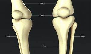 Image result for Deformity of Fibular Head