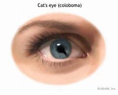 Image result for Cat Eyes Human Shape