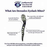 Image result for Eyelash Mites Symptoms