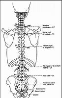 Image result for Lumbar Spine Anatomical Landmarks