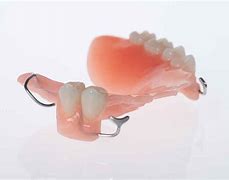 Image result for Acrylic Denture with Wrought Wire Clasps