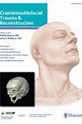 Image result for Craniofacial Surgery