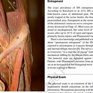 Image result for Ilioinguinal Nerve Sensory