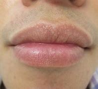 Image result for Lips Assessment