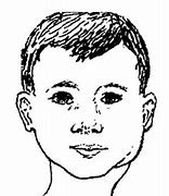 Image result for Mumps Drawing