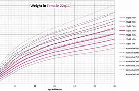 Image result for DiGeorge Growth Chart