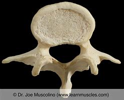 Image result for L5 Lumbar Vertebrae