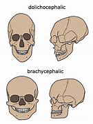 Image result for Elongated Skulls Species