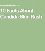 Image result for Candida Skin Rash Symptoms