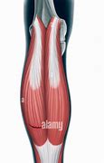 Image result for Tear in Calf Muscle