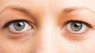 Image result for Examples of Hooded Eyes