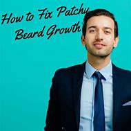 Image result for Growing Out a Patchy Beard