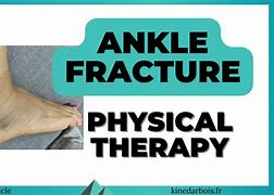 Image result for Left Lateral Malleolus Fracture