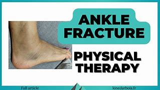 Image result for Verticam Medial Malleolus Fracture