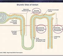 Image result for Diuretics for Hypertension