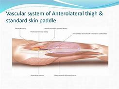 Image result for Anterolateral Thigh Flap