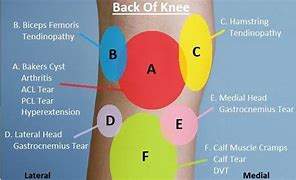 Image result for Left Side Knee Pain