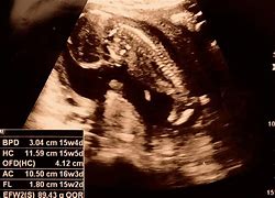 Image result for 15 Weeks Fetal