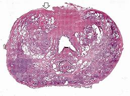 Image result for Prostate Gland Structure