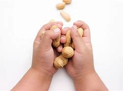 Image result for Peanut Butter Allergic Reaction