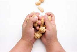 Image result for Peanut Butter Allergic Reaction