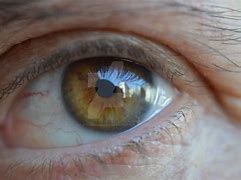 Image result for My Eye in Macro