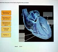 Image result for Myocardium of Interventricular Septum