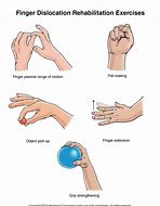 Image result for Dislocated Finger Joint