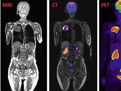 Image result for Pet MRI Scan