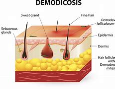 Image result for Face Mites Domedex