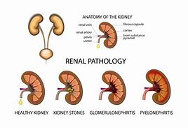 Image result for Ureter Graphics