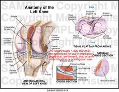 Image result for Left Knee