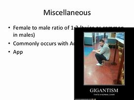 Image result for Example of Gigantism