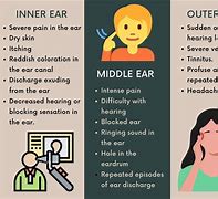 Image result for Inner Ear Infection Vertigo