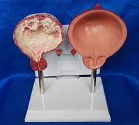 Image result for Normal Bladder