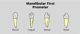 Image result for Mandibular 1st Premolar