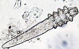 Image result for Demodex On Face